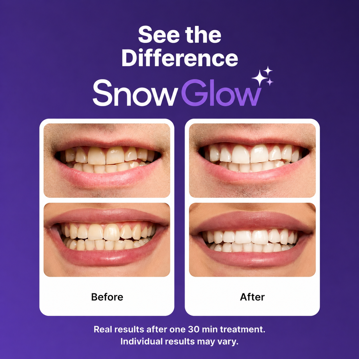 Purple Teeth Whitening Strips